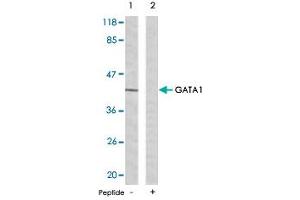 Western blot analysis of extracts from K-562 cells using GATA1 polyclonal antibody . (GATA1 anticorps  (Ser142))
