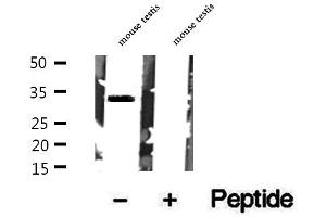 Western blot analysis of extracts of mouse testis tissue, using Syntaxin 17 antibody. (Syntaxin 17 anticorps  (C-Term))