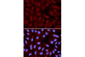 Immunofluorescence analysis of U2OS cell using SFTPC antibody. (Surfactant Protein C anticorps  (AA 1-197))