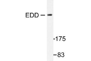 Image no. 1 for anti-Ubiquitin Protein Ligase E3 Component N-Recognin 5 (UBR5) antibody (ABIN271946) (UBR5 anticorps)