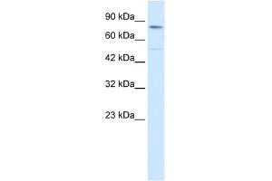 WB Suggested Anti-ZNF341 Antibody Titration: 0. (ZNF341 anticorps  (Middle Region))