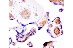 IHC(P): Human Placenta Tissue (WNT5A anticorps  (AA 184-303))
