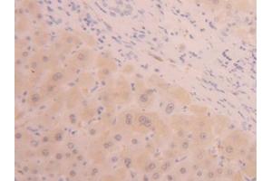 DAB staining on IHC-P; Samples: Human Liver Tissue (ALT anticorps  (AA 367-480))