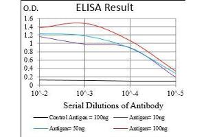 Black line: Control Antigen (100 ng), Purple line: Antigen(10 ng), Blue line: Antigen (50 ng), Red line: Antigen (100 ng), (GABBR2 anticorps  (AA 319-483))