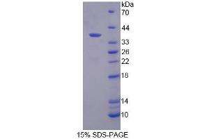 SDS-PAGE analysis of Human RGS9 Protein.
