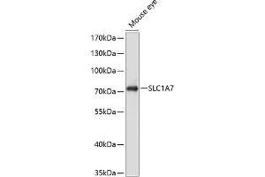 Western blot analysis of extracts of mouse eye, using SLC1 antibody (ABIN6129470, ABIN6147878, ABIN6147879 and ABIN6214419) at 1:1000 dilution. (SLC1A7 anticorps  (AA 115-220))