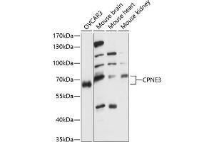Western blot analysis of extracts of various cell lines, using CPNE3 antibody (ABIN7266500) at 1:1000 dilution. (Copine III anticorps  (AA 238-537))