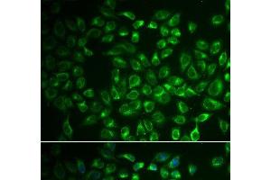 Immunofluorescence analysis of A549 cells using FABP6 Polyclonal Antibody (FABP6 anticorps)