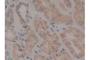 DAB staining on IHC-P; Samples: Human Kidney Tissue