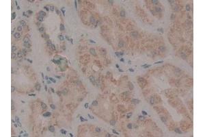 DAB staining on IHC-P; Samples: Human Kidney Tissue (WNT2 anticorps  (AA 26-360))