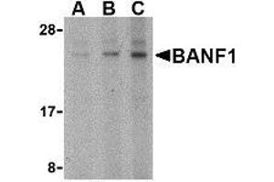 Western blot analysis of BANF1 in mouse kidney tissue lysate with AP30119PU-N BANF1 antibody at (A) 0. (BANF1 anticorps  (N-Term))