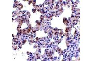 Immunohistochemistry (IHC) image for anti-Presenilin Enhancer 2 Homolog (PSENEN) (N-Term) antibody (ABIN1031508) (PEN2 anticorps  (N-Term))
