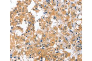 Immunohistochemistry (IHC) image for anti-Cerebellar Degeneration-Related Protein 2, 62kDa (CDR2) antibody (ABIN2423130) (CDR2 anticorps)