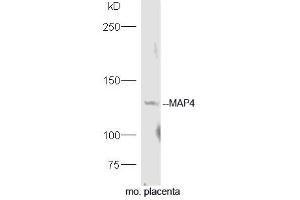 Mouse placenta lysates probed with Rabbit Anti-MAP4 Polyclonal Antibody, Unconjugated (ABIN754243) at 1:300 overnight at 4˚C. (MAP4 anticorps  (AA 701-800))