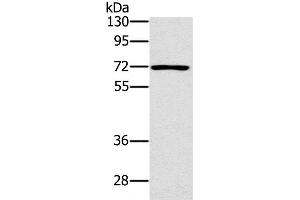 Western Blot analysis of Raji cell using PLS3 Polyclonal Antibody at dilution of 1:400 (Plastin 3 anticorps)