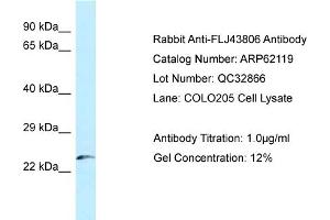 Western Blotting (WB) image for anti-Kazrin (KAZ) (N-Term) antibody (ABIN2781340) (Kazrin anticorps  (N-Term))