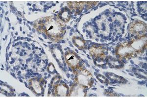 Human kidney; TRIM68 antibody - middle region in Human kidney cells using Immunohistochemistry (TRIM68 anticorps  (Middle Region))