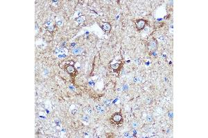 Immunohistochemistry of paraffin-embedded Mouse spinal cord using WWC1 Rabbit pAb (ABIN7271388) at dilution of 1:100 (40x lens). (WWC1 anticorps  (AA 950-1050))