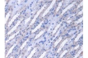 Detection of FUM in Mouse Kidney Tissue using Polyclonal Antibody to Fumarase (FUM)