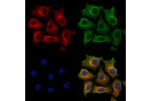 ABIN7094363 and ABIN7098410 staining HepG2 cells by IF/ICC. (STARD3 anticorps  (Internal Region))