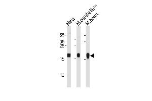 NDUFS7 Antibody (Center) (ABIN1881572 and ABIN2843449) western blot analysis in Hela cell line and mouse cerebellum,heart tissue lysates (35 μg/lane). (NDUFS7 anticorps  (AA 119-146))