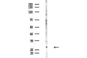 anti-Ring Finger Protein 144A (RNF144A) (Internal Region) antibody