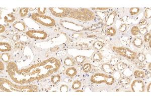 Detection of ACO1 in Human Kidney Tissue using Polyclonal Antibody to Aconitase 1 (ACO1)