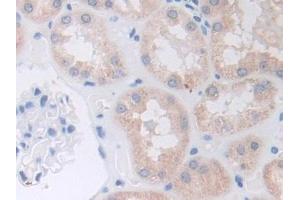 DAB staining on IHC-P; Samples: Human Kidney Tissue