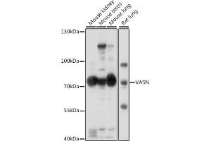 Western blot analysis of extracts of various cell lines, using VASN antibody (ABIN7271301) at 1:1000 dilution.