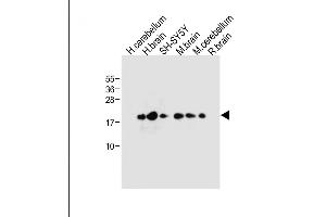 All lanes : Anti-FXYD6 Antibody (C-term) at 1:1000 dilution Lane 1: Human cerebellum tissue lysate Lane 2: Human brain tissue lysate Lane 3: SH-SY5Y whole cell lysate Lane 4: Mouse brain tissue lysate Lane 5: Mouse cerebellum tissue lysate Lane 6: Rat brain tissue lysate Lysates/proteins at 20 μg per lane.