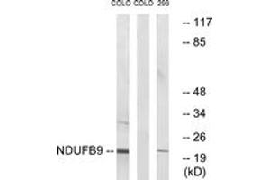 Western blot analysis of extracts from COLO205 cells/293 cells, using NDUFB9 Antibody. (NDUFB9 anticorps  (AA 102-151))
