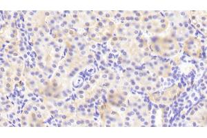 anti-Integrin alpha 2 (ITGA2) (AA 678-894) antibody