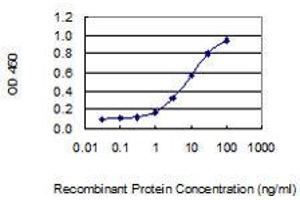 anti-Cytoplasmic Linker Associated Protein 2 (CLASP2) (AA 1-431) antibody