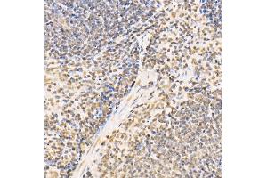 Immunohistochemistry of paraffin-embedded mouse spleen using SS18 Rabbit pAb (ABIN6133185, ABIN6148473, ABIN6148474 and ABIN6222754) at dilution of 1:100 (40x lens). (SS18 anticorps  (AA 1-240))
