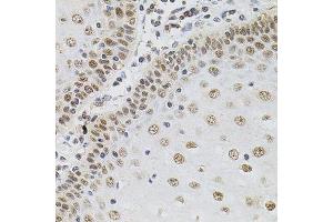 Immunohistochemistry of paraffin-embedded human esophagus using TGM2 antibody. (Transglutaminase 2 anticorps)