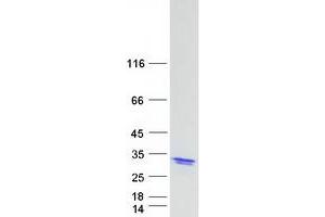 Validation with Western Blot