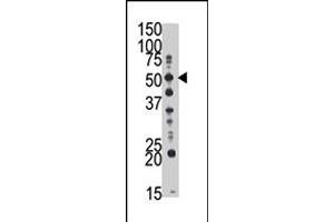 The GCNT1 polyclonal antibody  is used in Western blot to detect GCNT1 in mouse kidney tissue lysate . (GCNT1 anticorps  (Internal Region))