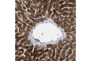 Immunohistochemical staining of human liver with ASGR1 polyclonal antibody  shows strong positivity in hepatocytes. (Asialoglycoprotein Receptor 1 anticorps)