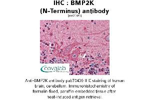 Image no. 1 for anti-BMP2 Inducible Kinase (BMP2K) (N-Term) antibody (ABIN1732361)