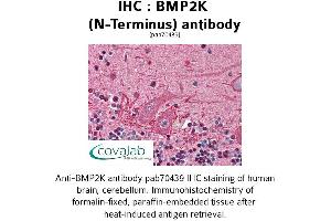 Image no. 1 for anti-BMP2 Inducible Kinase (BMP2K) (N-Term) antibody (ABIN1732361)