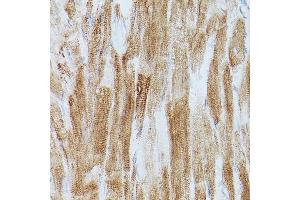 Immunohistochemistry of paraffin-embedded mouse brain using SERC/ Rabbit pAb (ABIN3021429, ABIN3021430, ABIN3021431 and ABIN6215028) at dilution of 1:150 (40x lens).
