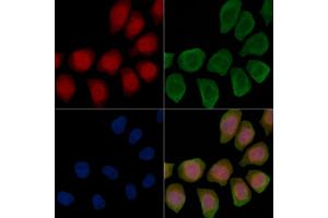 Phospho-IP3 Receptor (Ser1598) Antibody staining Hela cells(45 min of heat-shock treatment) by IF/ICC. (IP3 Receptor anticorps  (pSer1598))