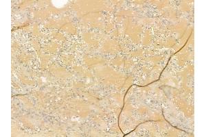 ABIN6265968 and ABIN6277114 at 1/100 staining human normal lung tissue by IHC-P.