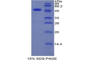 SDS-PAGE analysis of Human Interferon alpha Protein.