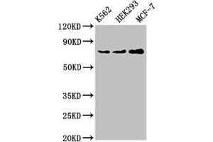 Western Blot Positive WB detected in: K562 whole cell lysate, HEK293 whole cell lysate, MCF-7 whole cell lysate All lanes: RALBP1 antibody at 4 μg/mL Secondary Goat polyclonal to rabbit IgG at 1/50000 dilution Predicted band size: 77 kDa Observed band size: 77 kDa (RALBP1 anticorps  (AA 6-105))