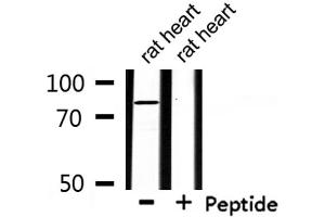 Western blot analysis of extracts from rat heart , using ZFYVE20 Antibody. (Rabenosyn 5 anticorps  (Internal Region))