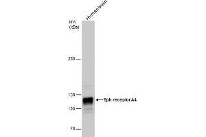 WB Image Eph receptor A4 antibody detects Eph receptor A4 protein by western blot analysis. (EPH Receptor A4 anticorps)