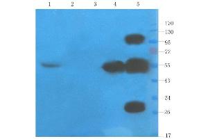 Western Blot using anti-TNFalpha antibody  Rat liver (lane 1), rat spinal cord (lane 2), mouse testis (lane 3), rat colon (lane 4) and human thyroid tumour (lane 5) samples were resolved on a 10% SDS PAGE gel and blots probed with  at 1 µg/ml before being detected by a secondary antibody. (Recombinant TNF alpha (Humicade Biosimilar) anticorps)