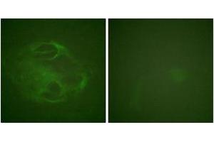 Immunofluorescence analysis of HeLa cells, using HRS (Ab-334) Antibody. (HRS (HRS) (AA 301-350) anticorps)