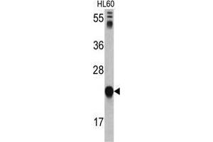 Western blot analysis of GLO1 antibody (N-term) in HL60 cell line lysates (35 µg/lane). (GLO1 anticorps  (N-Term))